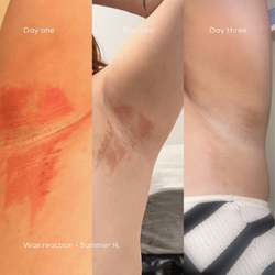 Bbefore picture of an arm around the elbow that is irritated and the after picture of applying the organic balm that revitalizes the skin and the after picture of the redness is gone